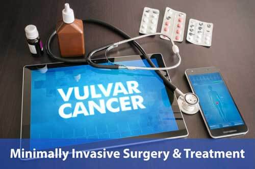 vulvar cancer